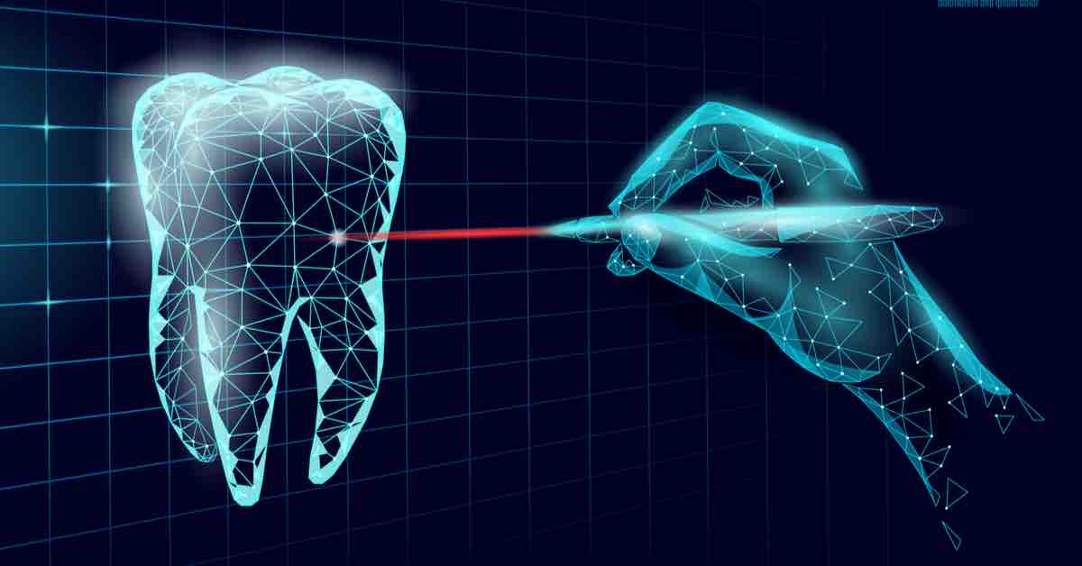 laser dentistry facts