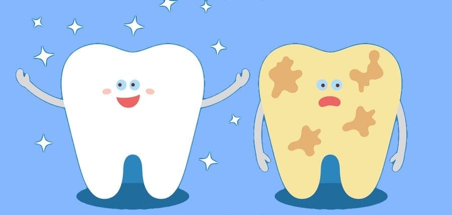 What Causes Discoloration of Teeth?