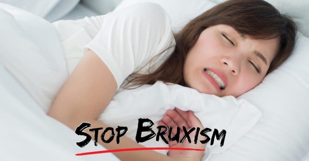 Bruxism &Amp; Benefits Of A Night Guard To Prevent Teeth Grinding Bruxism Bruxism &Amp; Benefits Of A Night Guard To Prevent Teeth Grinding