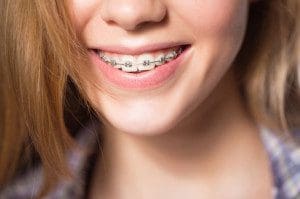 Are Your Teenagers Taking Good Care Of Their Teeth?
