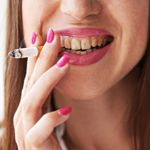 5 Simple Lifestyle Changes For Better Dental Health Lifestyle Changes For Better Dental Health 5 Simple Lifestyle Changes For Better Dental Health