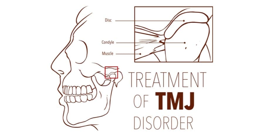 Tmj Therapy Tmj Treatment Tmj Therapy Temporomandibular Joint Syndrome