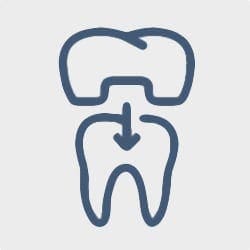 Dental Crowns Dental Crowns Dental Crowns
