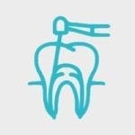 Dental Services Root Canal