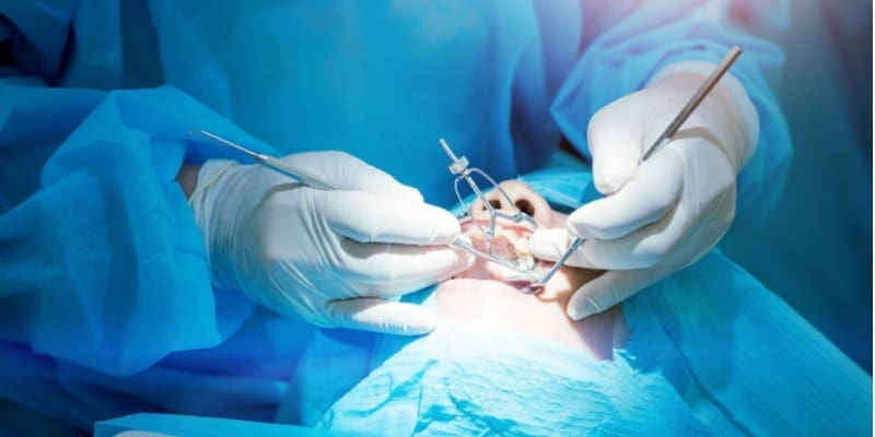 Oral Surgery Oral Surgery Oral Surgery