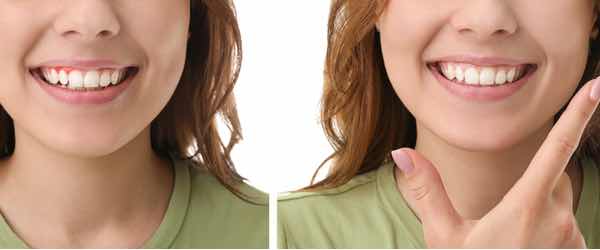 Periodontics Periodontal Treatments Periodontal Treatments