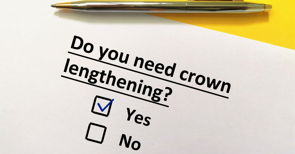 Crown Lengthening: Reasons, Process, Benefits